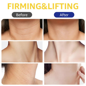 Botanikind neck-firming-cream-roller-lift visibly helps the neck look lifted.