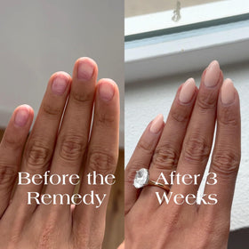 Botanist Nails The Remedy color swatches reveal rosy to nude shades.