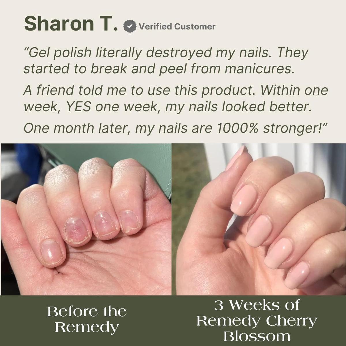 Botanist Nails The Remedy growth glow hints at healthier-looking nails over time.