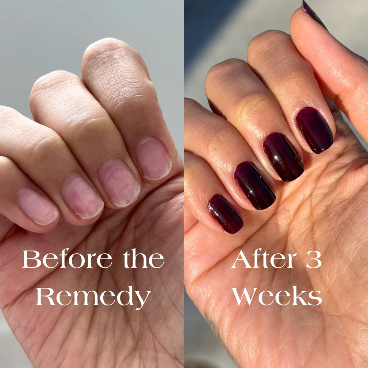 Botanist Nails The Remedy application brush ready for quick, base-coat-free application.