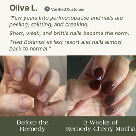 Botanist Nails The Remedy kit contents including growth serum for a complete routine.