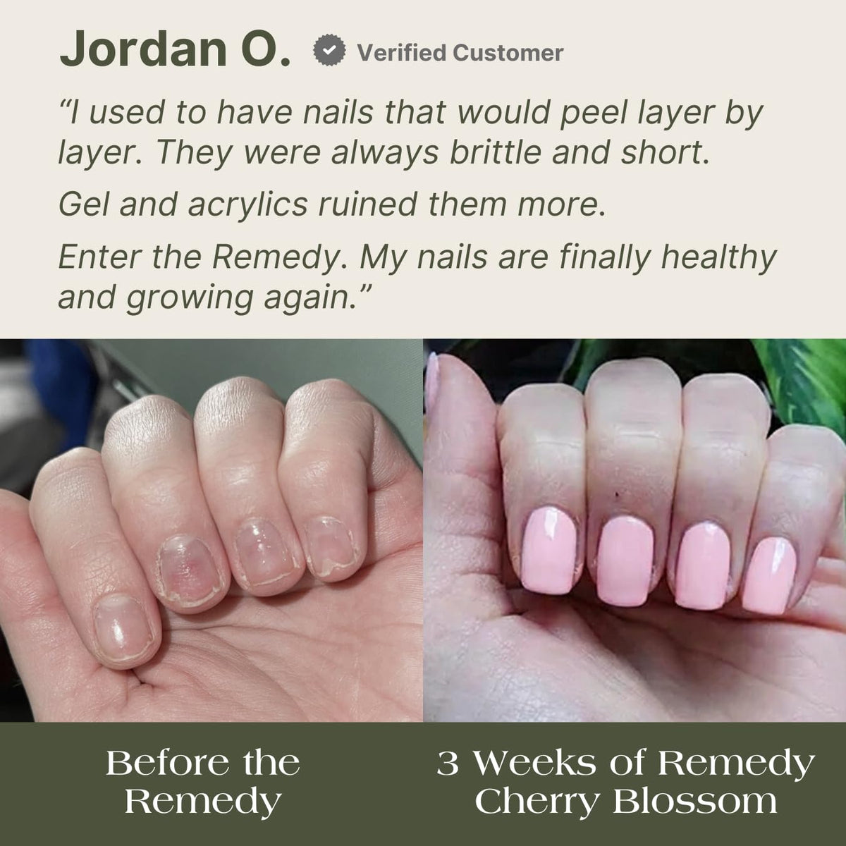 Botanist Nails The Remedy liquid consistency for easy at-home use.