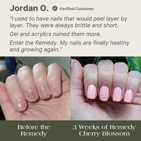 Botanist Nails The Remedy liquid consistency for easy at-home use.