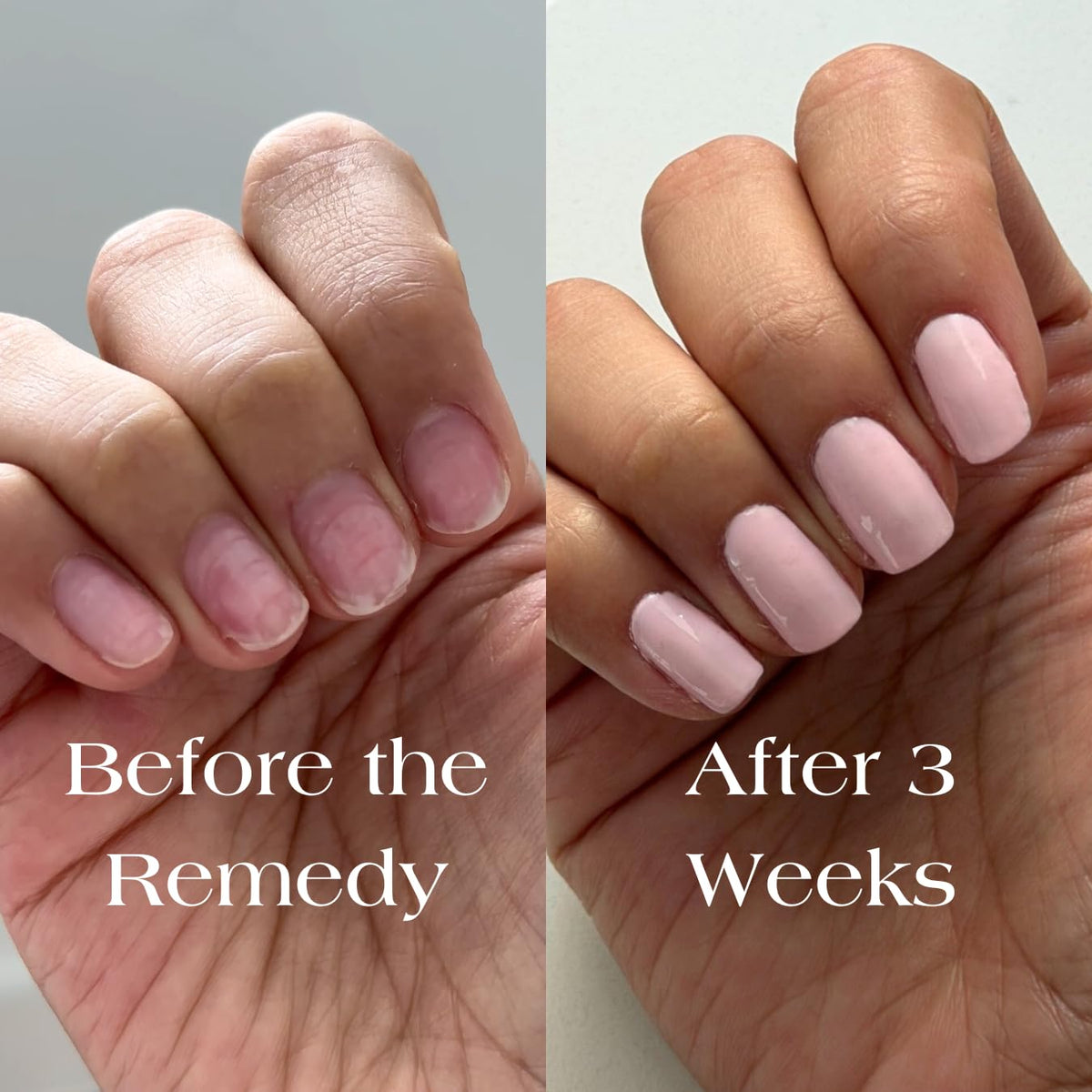Botanist Nails The Remedy swirl texture in the polish bottle.