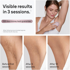 Braun Silk-Expert Mini used on bikini area for comfortable at-home treatment.