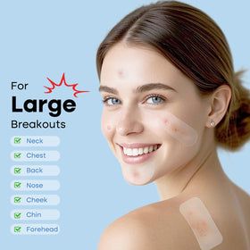 Salicylic acid active patches help clear clogged pores.