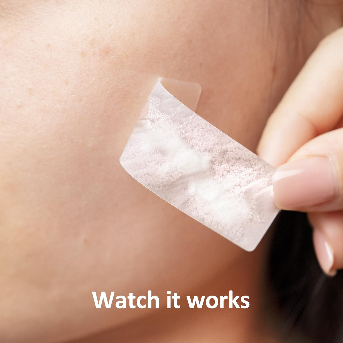 Breiboz patch with salicylic acid supports pore clearing.