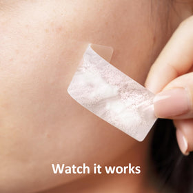 Breiboz patch with salicylic acid supports pore clearing.