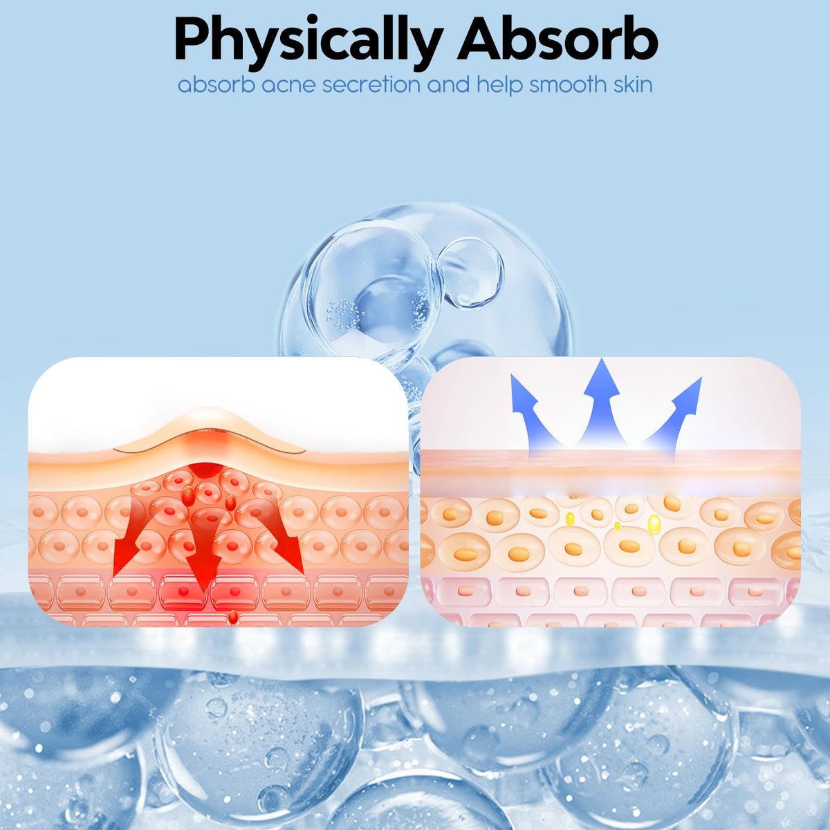 Waterproof adhesive patches stay put during daily activities.