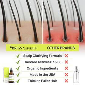 Brigs Naturals Hair Boost Spray biotin support for stronger-looking strands.