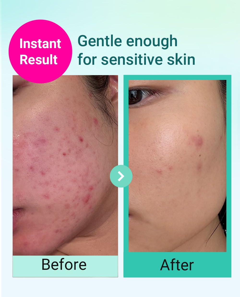 Bring Green Deep Cleansing Foam squeezable tube removes impurities.