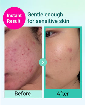 Bring Green Deep Cleansing Foam squeezable tube removes impurities.