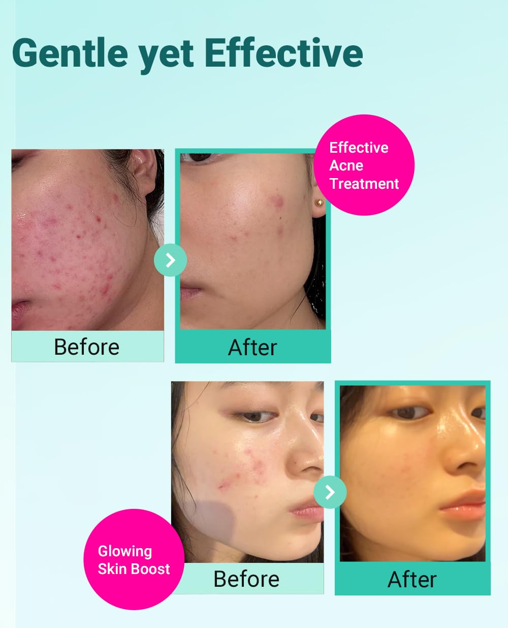 BRING GREEN Tea Tree Cica Cream jar highlights lightweight hydration without grease