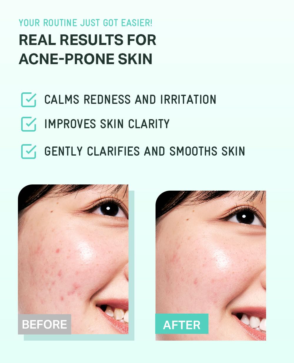 BRING GREEN Tea Tree CICA Toner applied to face after cleansing