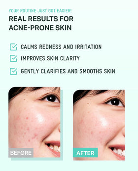 BRING GREEN Tea Tree CICA Toner applied to face after cleansing