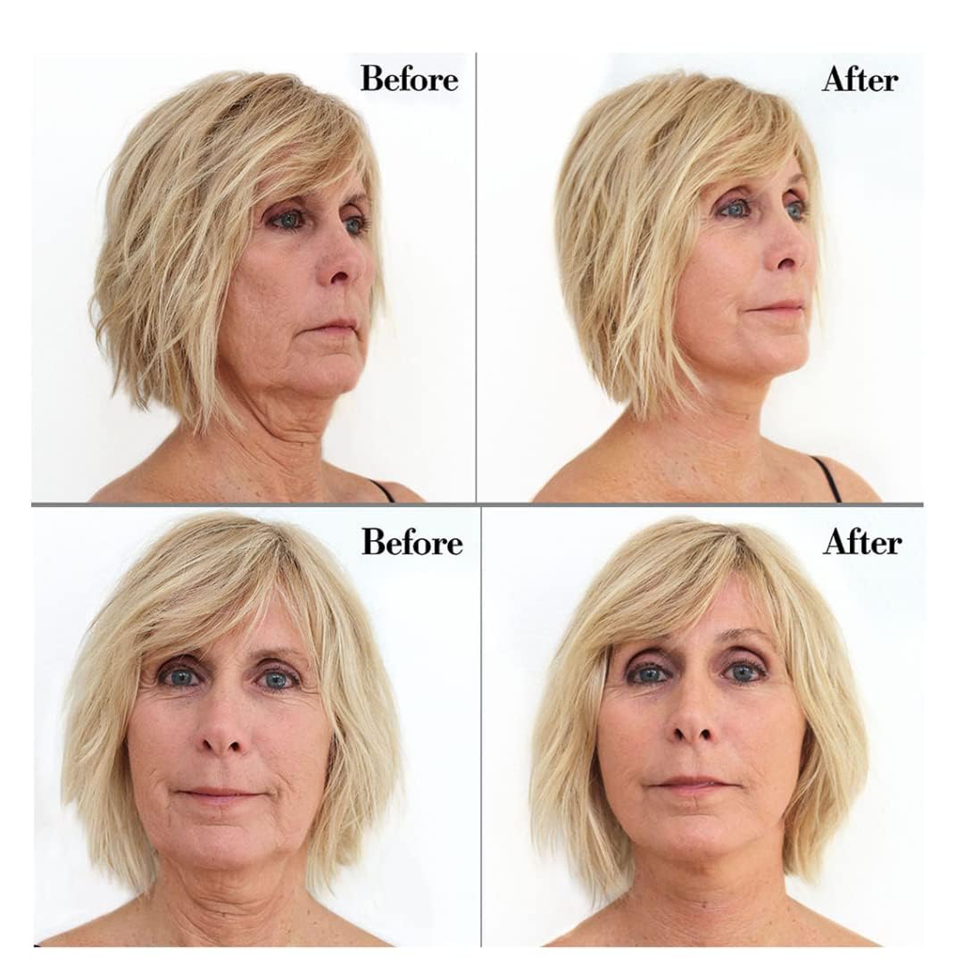Bring It Up neck lift tape uses hypoallergenic medical-grade adhesive for sensitive skin.