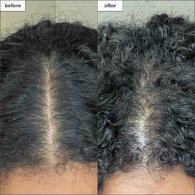 Briogeo Scalp Revival coconut oil surface highlights added scalp moisture.