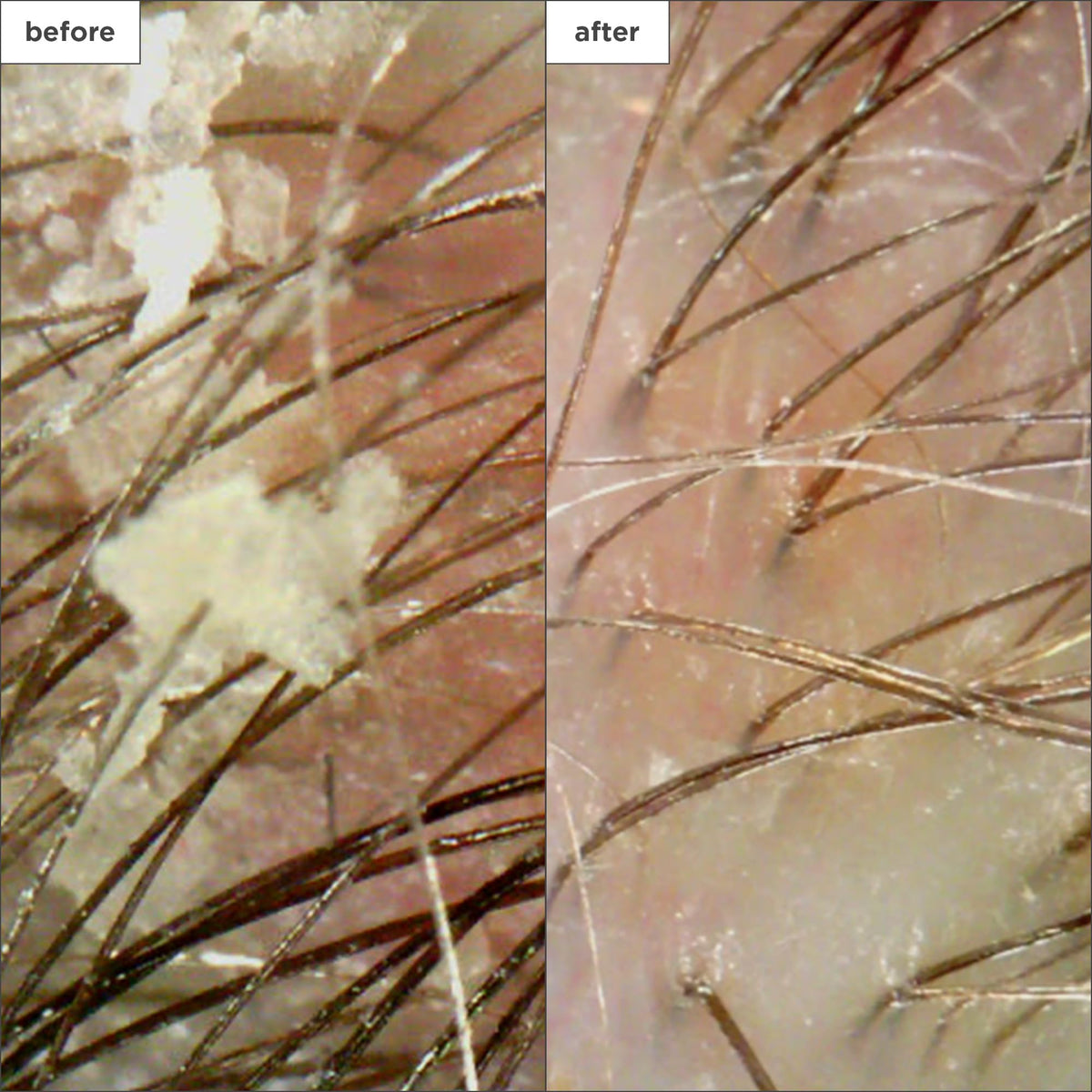 Briogeo Scalp Revival peppermint cooling close-up conveys refreshing scalp sensation.