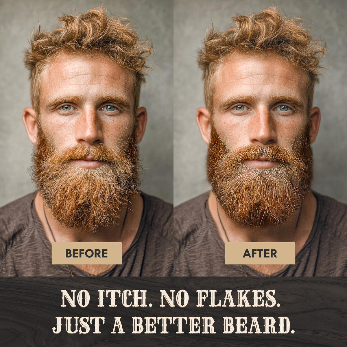 Bronmans beard balm on cheek closeup highlighting soothing skin and scalp area