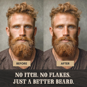 Bronmans beard balm on cheek closeup highlighting soothing skin and scalp area