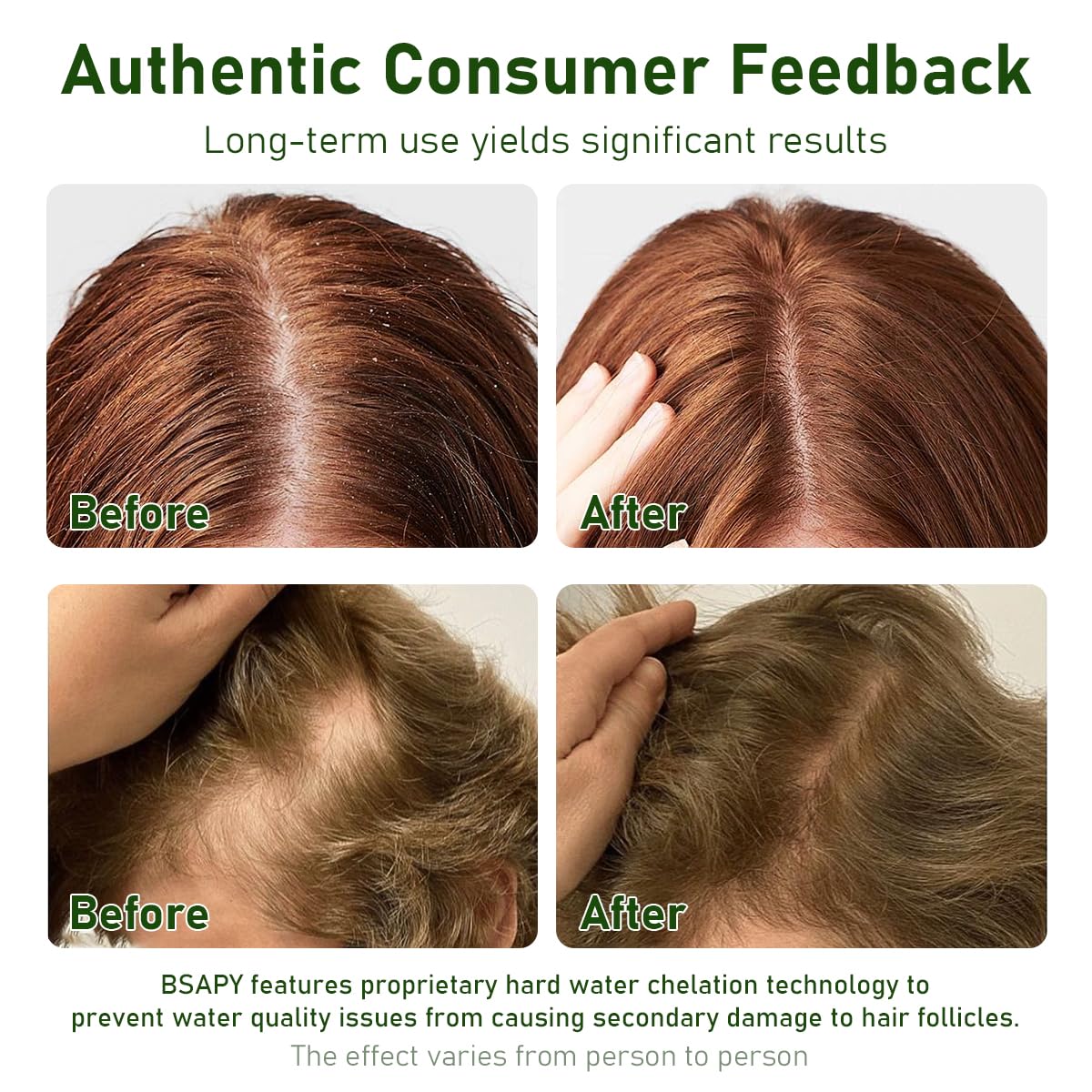 BSAPY root-strengthening-bar close-up visual for hair foundation.