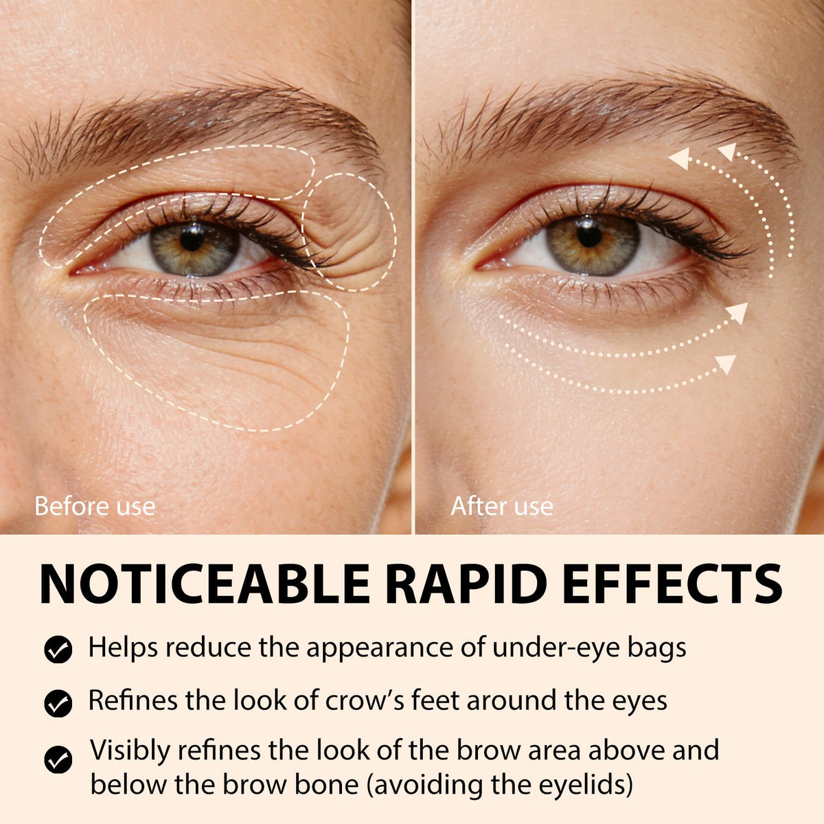 BXRUIAGN eye area lift effect showcases a refreshed, awake appearance.