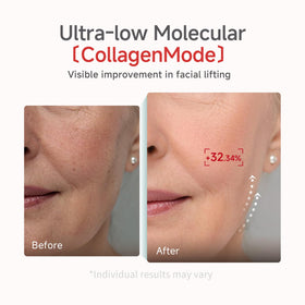 Candorlov CDL lotus-phytoPDRN panel highlights regenerative ingredients for skin support.