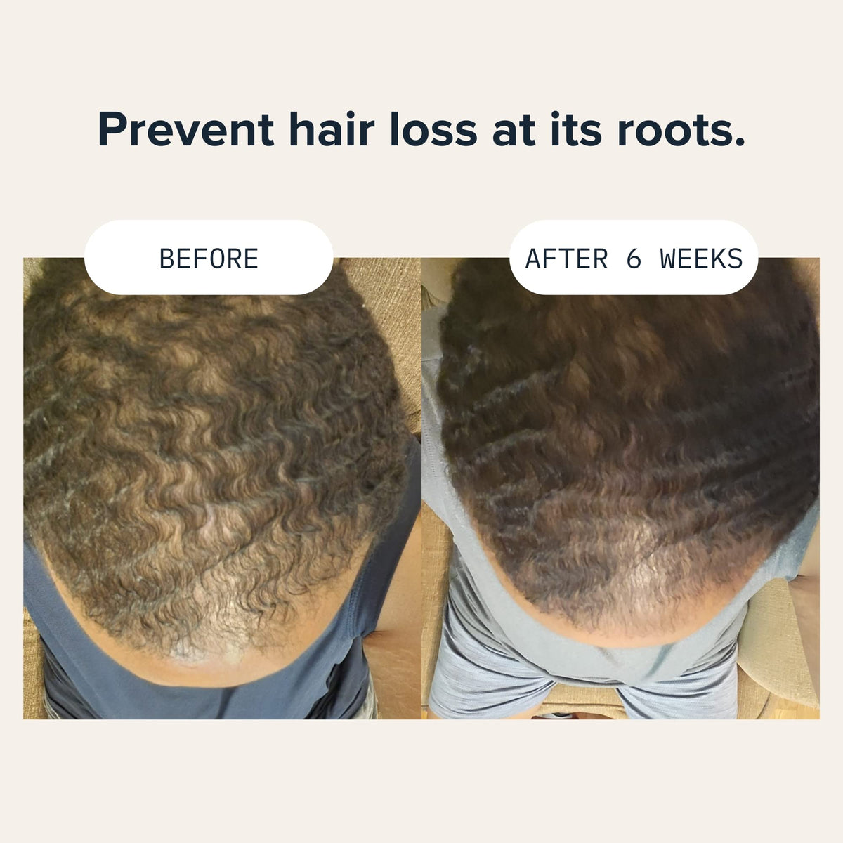Cardon Hair Growth Set routine step one image for daily cleansing.