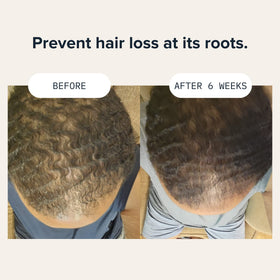 Cardon Hair Growth Set routine step one image for daily cleansing.
