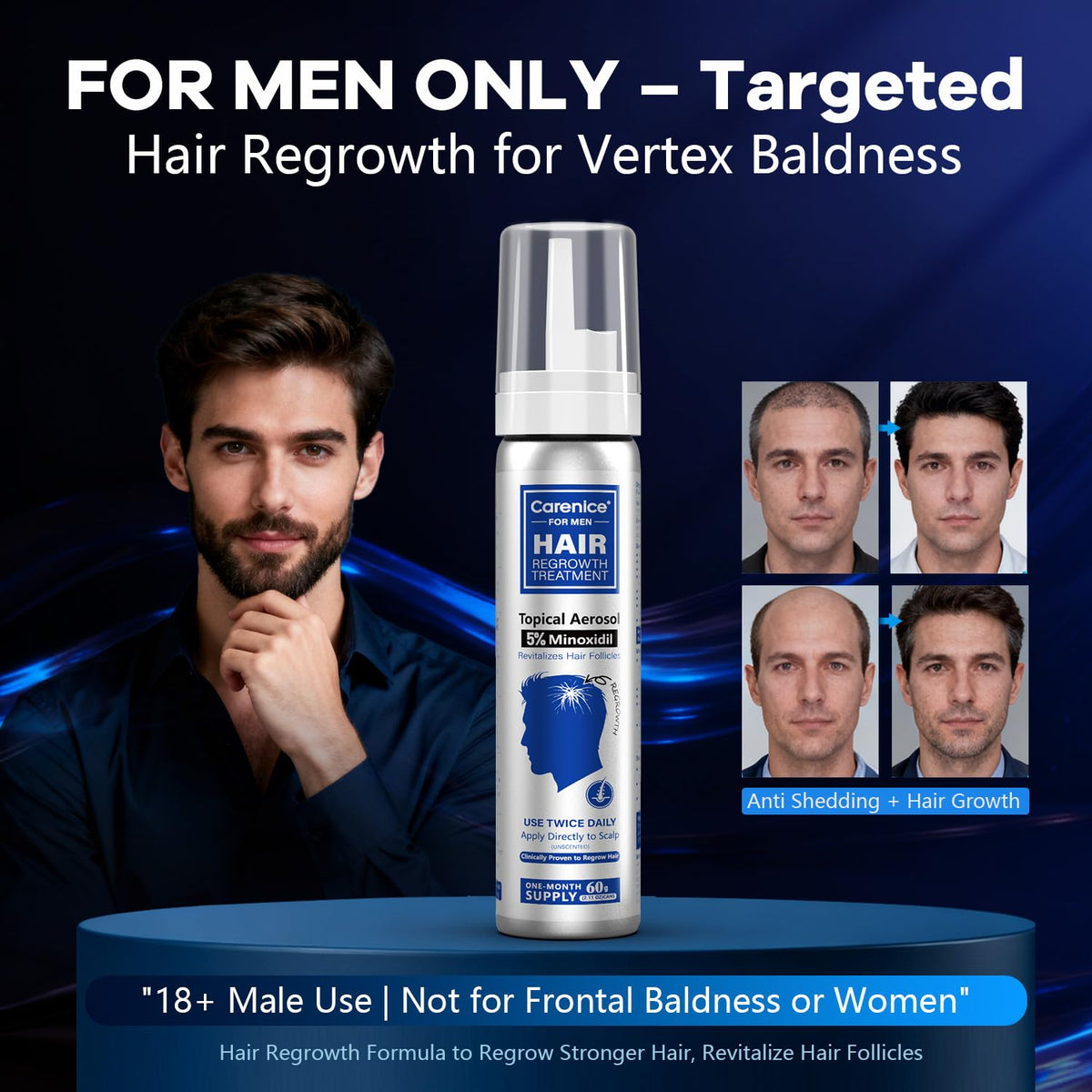 CARENICE biotin-infused minoxidil foam for healthier-looking strands