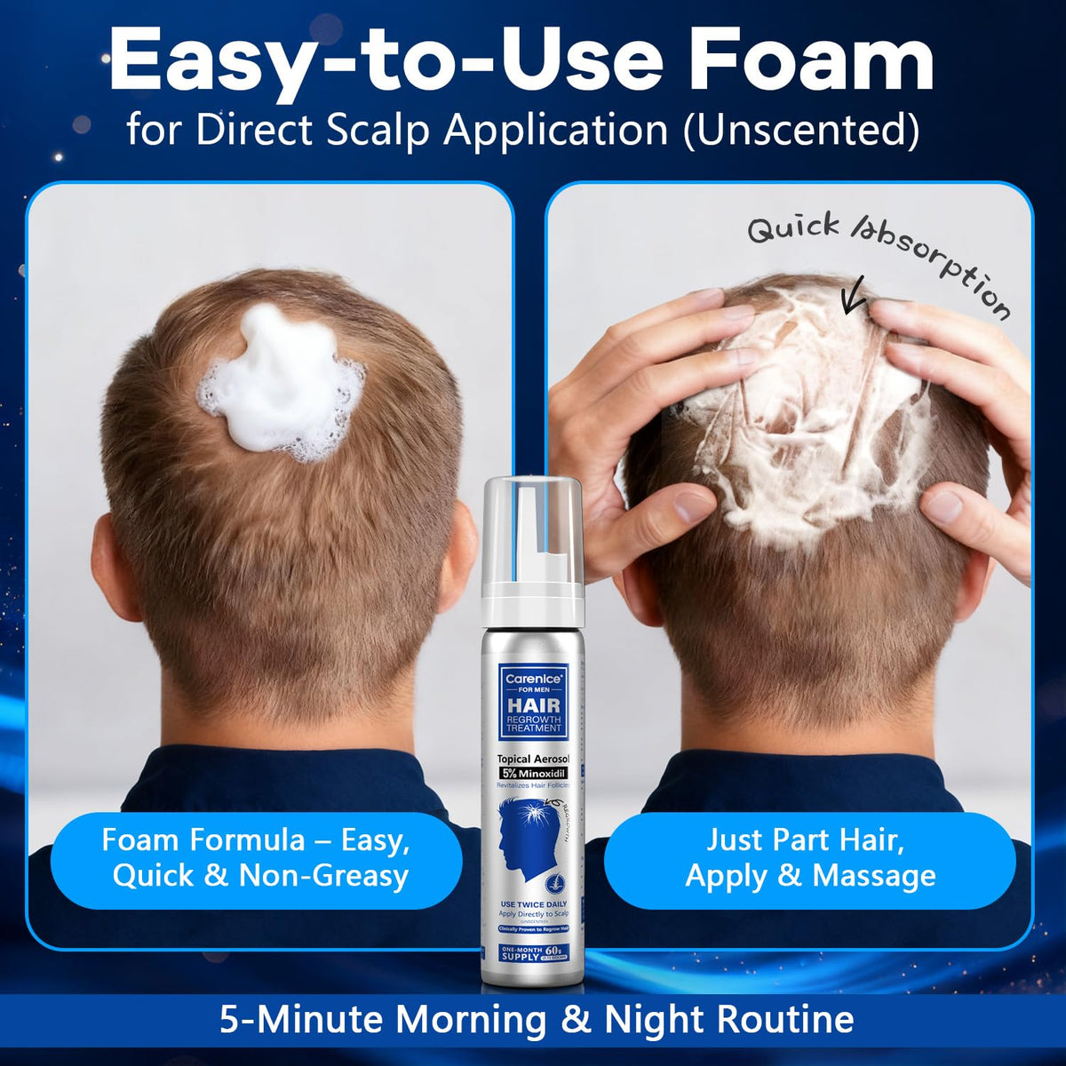 CARENICE beard area minoxidil support for fuller-looking facial hair
