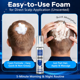 CARENICE beard area minoxidil support for fuller-looking facial hair