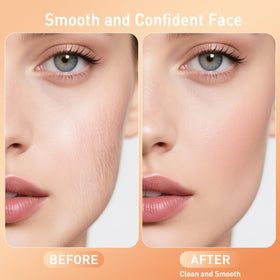 CatLane sonic exfoliation technology action demonstrates gentle skin resurfacing without irritation