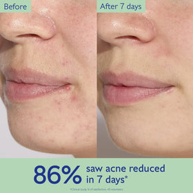 Caudalie Purifying Toner 50ml decongests and purifies skin