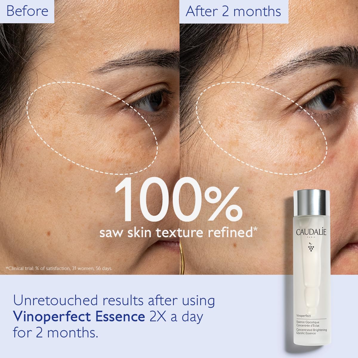 Close-up of the Vinoperfect Brightening Essence cap highlighting design and premium feel.