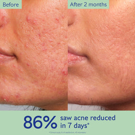 Caudalie Vinopure serum application close-up showing smooth texture