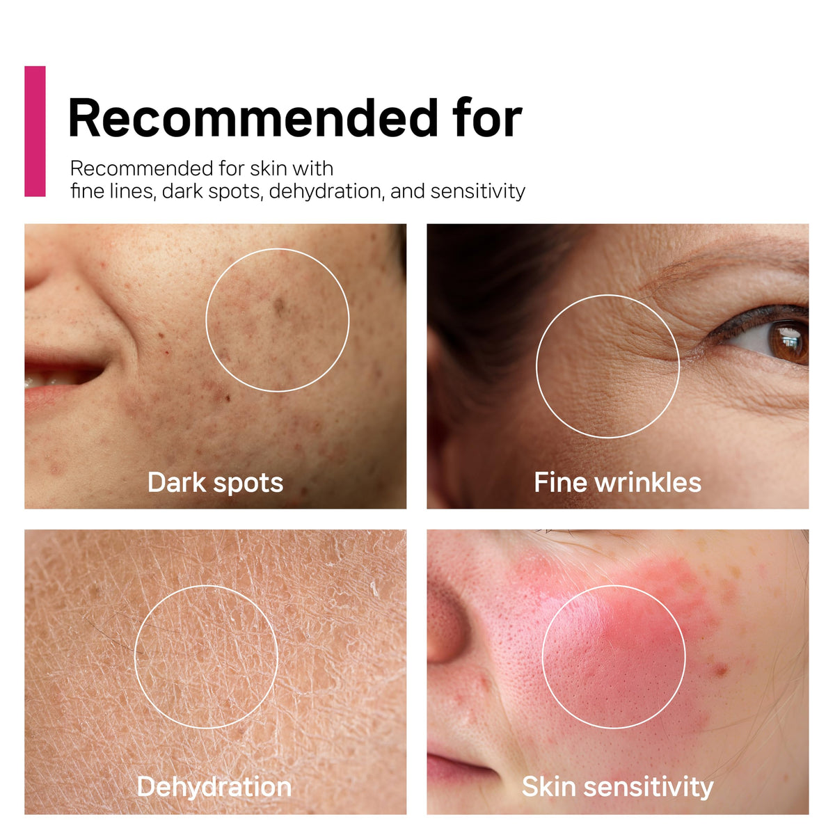 Niacinamide 2% cream swirl suggesting balanced, calmer complexion