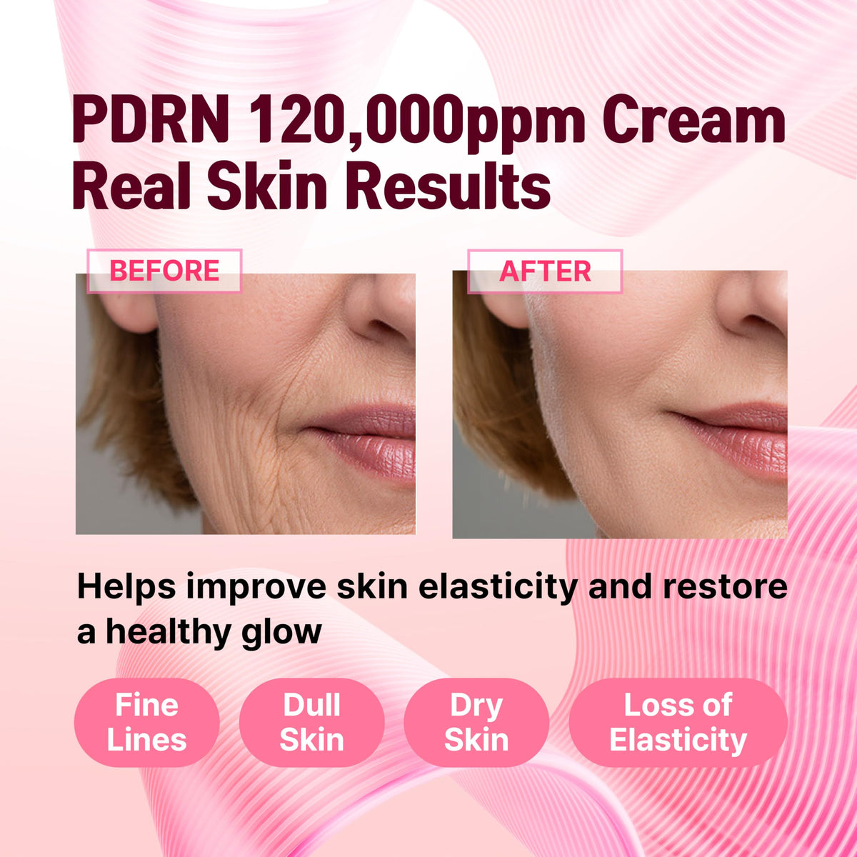 CELDYQUE Volufiline Salmon DNA boost indicating firmer-looking skin