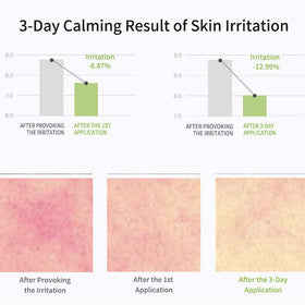 Celimax Real Noni Energy Repair Cream applying to skin during routine care.