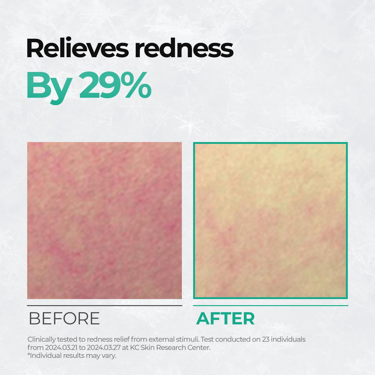 Pad gliding over redness-prone area for relief