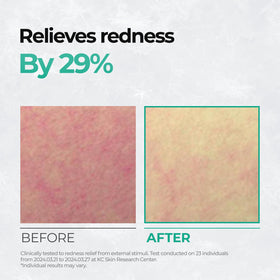 Pad gliding over redness-prone area for relief