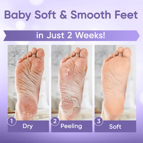 CÉLOR booties being applied to feet for a comfortable, spa-like treatment.