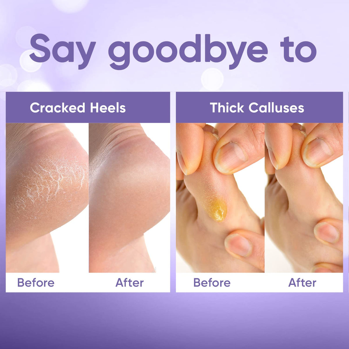 CÉLOR foot-peeling routine promotes smoother feet after treatment.