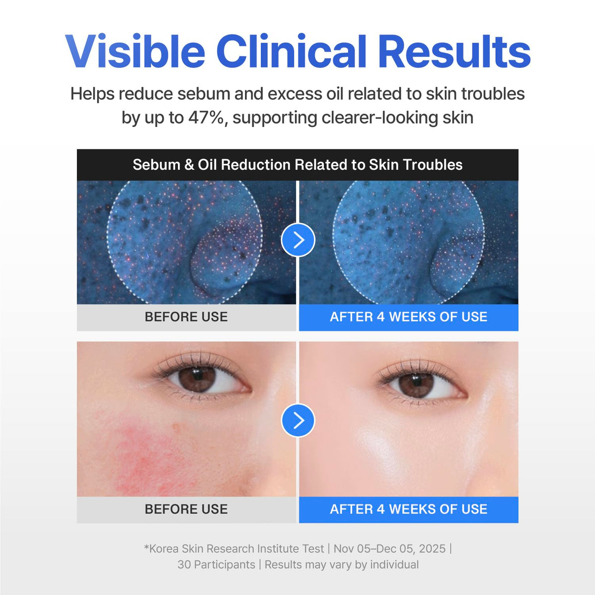 Cooling effect demonstration on CENTELLIAN 24 Madeca Cream Hydra Calming