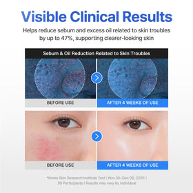 Cooling effect demonstration on CENTELLIAN 24 Madeca Cream Hydra Calming