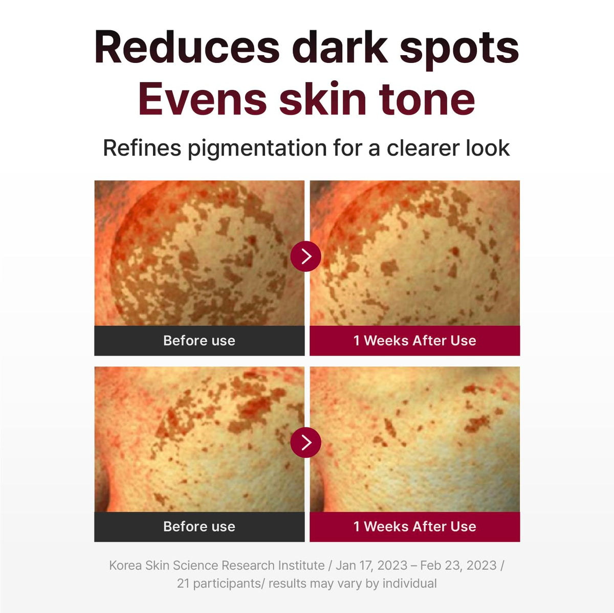 Centellian 24 Madeca Mela Capture Ampoule Pad applied on skin.