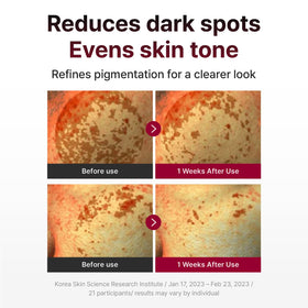 Centellian 24 Madeca Mela Capture Ampoule Pad applied on skin.