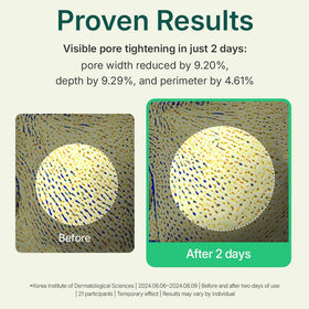 Snowflake-texture powder melts into skin for a soft matte finish