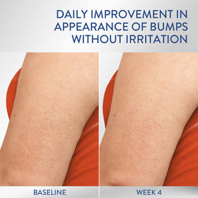 Fragrance-free Cetaphil label emphasizes sensitive-skin friendly formulation.