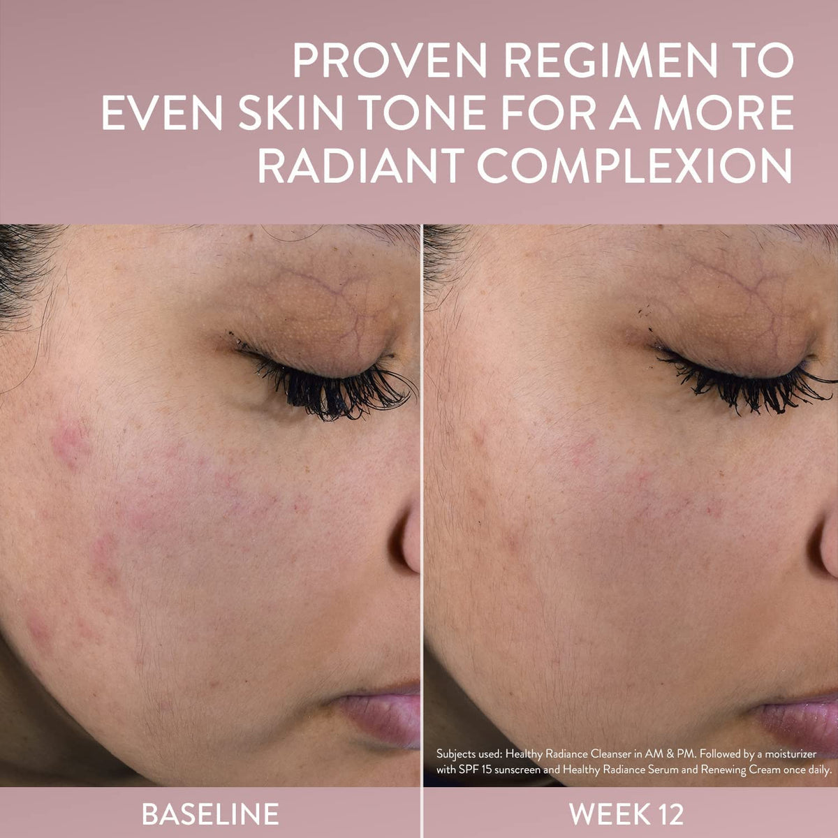 Ingredients panel highlights Niacinamide and Sea Daffodil for radiant skin.